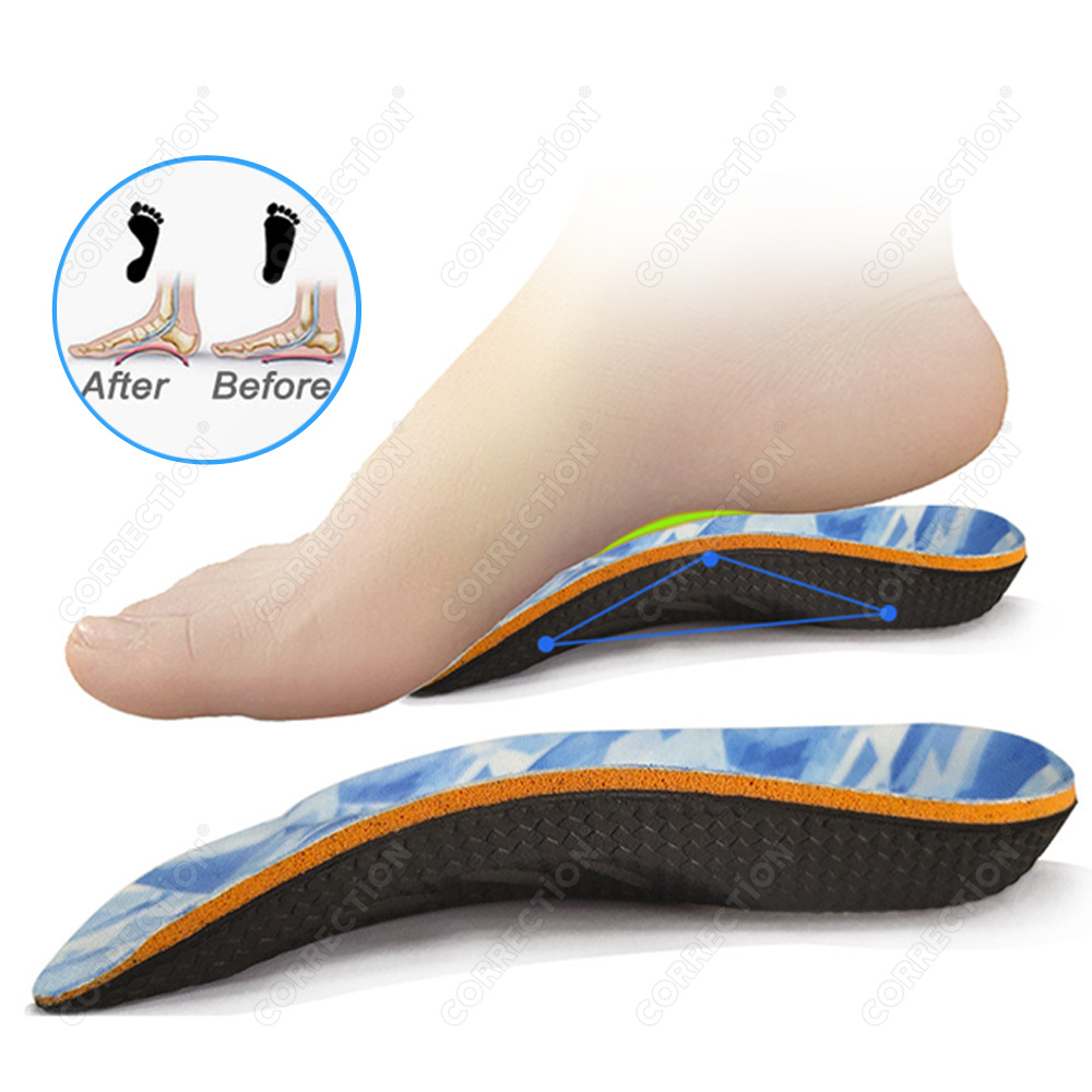 Orthopedic Insoles for Feet Sh - 3D Printing Orthopedics ulasan dan harga