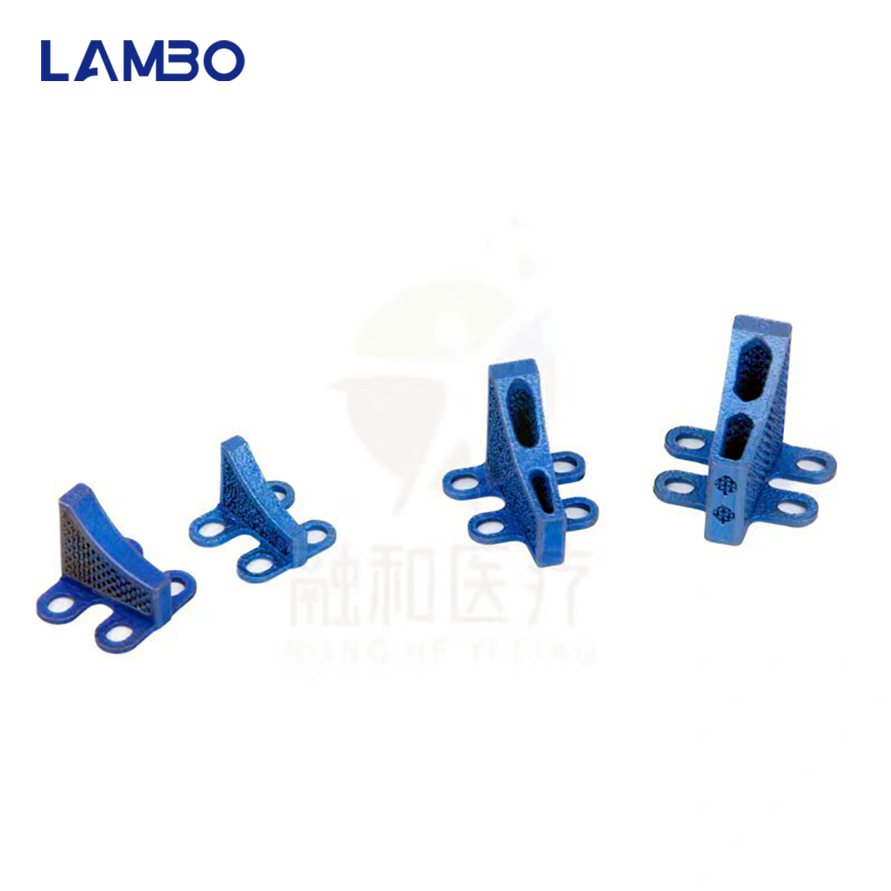 3D Printing TTA System Cage Bo - 3D Printing Orthopedics ulasan dan harga