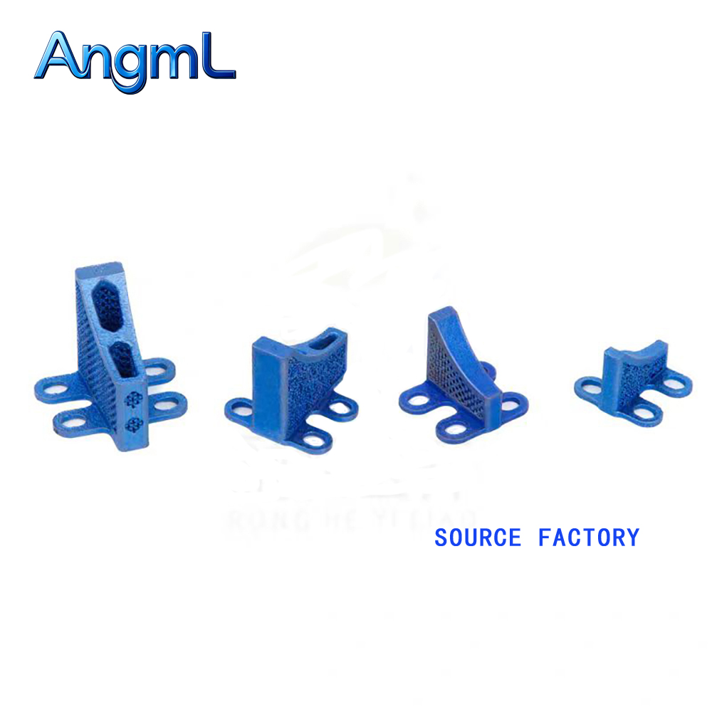 TC4 Titanium Alloy 3D Printed  - 3D Printing Orthopedics ulasan dan harga